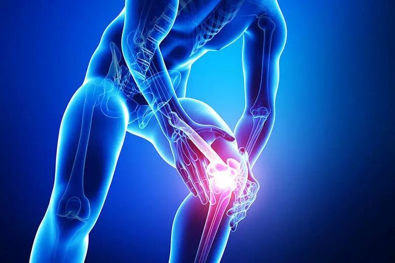 osteoarthritis symptoms